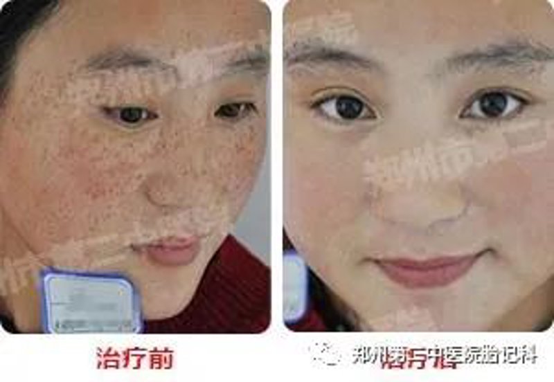 广州治疗胎记医院之医疗新趋势解读