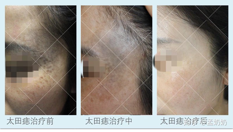 广州健肤皮肤专科门诊部：前沿技术开启肌肤焕新密码