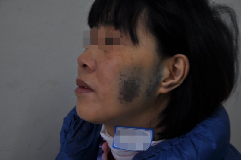 探寻广州健肤皮肤专科门诊部的新貌