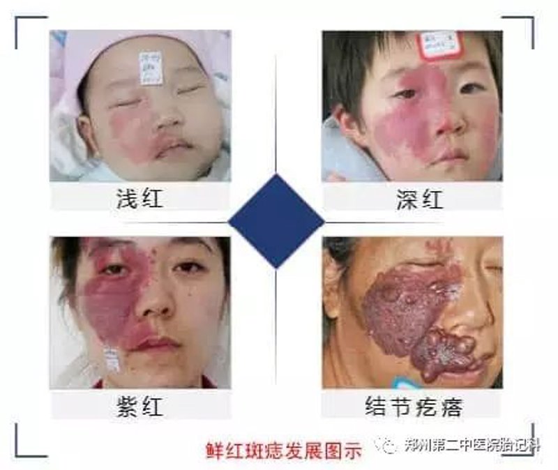 探寻广州健肤皮肤专科门诊部的新貌