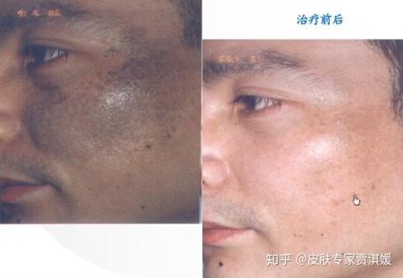 胎记医院在广州的发展轨迹和最新动态